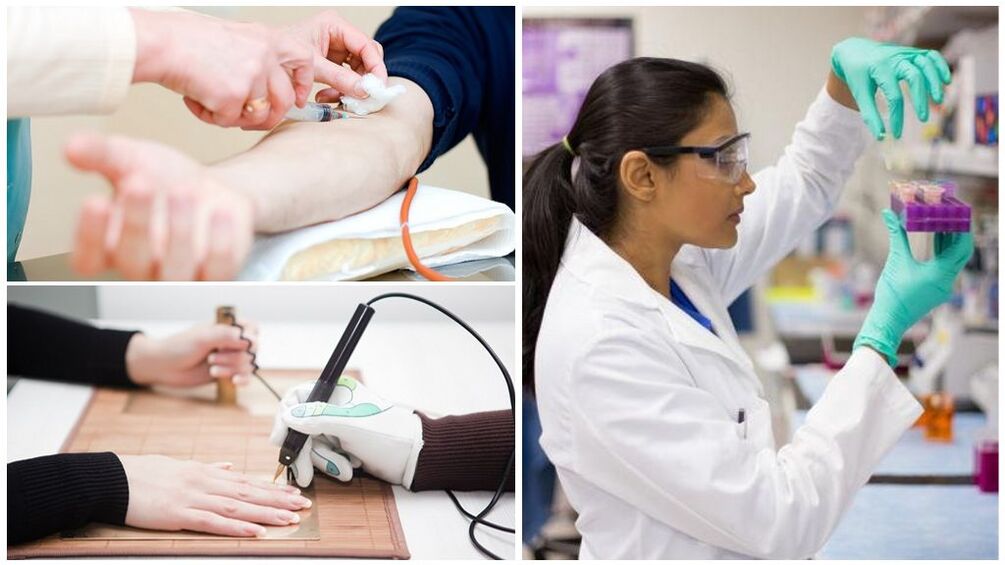 Diagnostilised meetodid parasiitide tuvastamiseks kehas