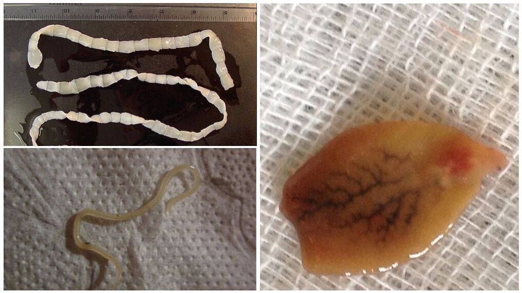 Parasiitide tüübid