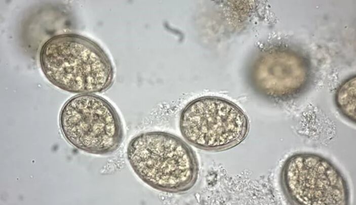 parasiidid mikroskoobi all