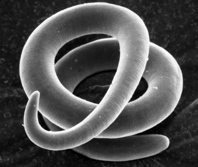 Trichinella mikroskoobi all